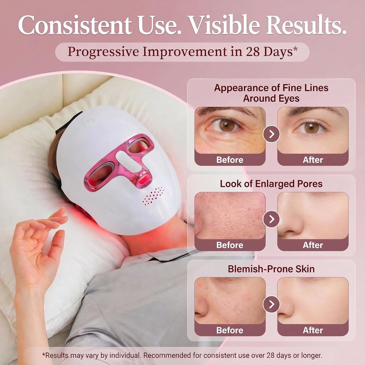 Red Light Therapy for Face, 7 Colors LED Face Mask Rechargeable